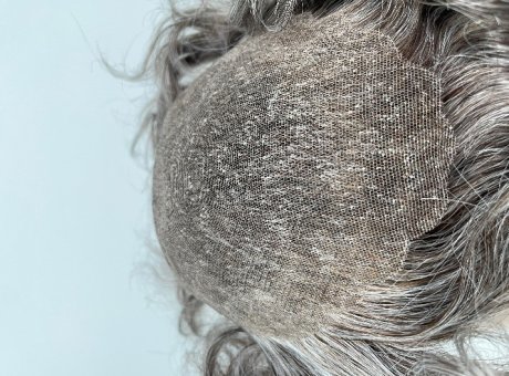 What is hair system scallop?