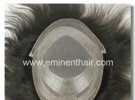 SUMMER HAIR SERIES:Best Type of Hair System for Summer！