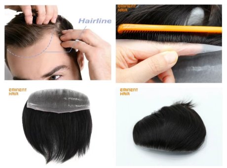 Full skin Frontal Hair System - Fix Your Receding Hairline!