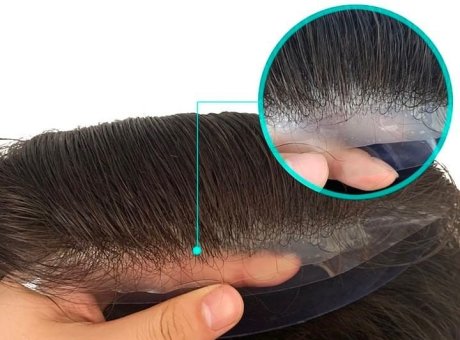 Custom Hair System for men