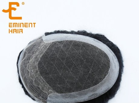 5 Reasons Why A Hair Systems is Better than A Hair Transplant