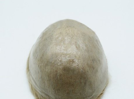 Thinnest Skin Hair Replacement