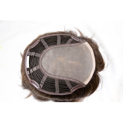 Hair Replacement  v}