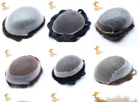 Causes of Hair Loss in the Crown Area